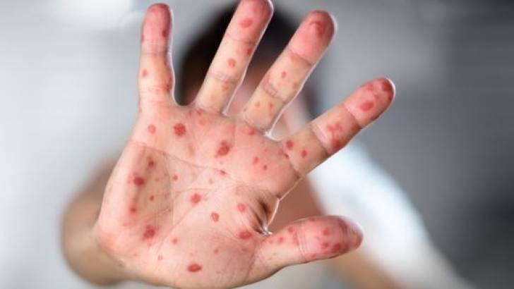 Le désert et l’anarchie sanitaire en « Algérie », un risque de graves épidémies nationales et internationales