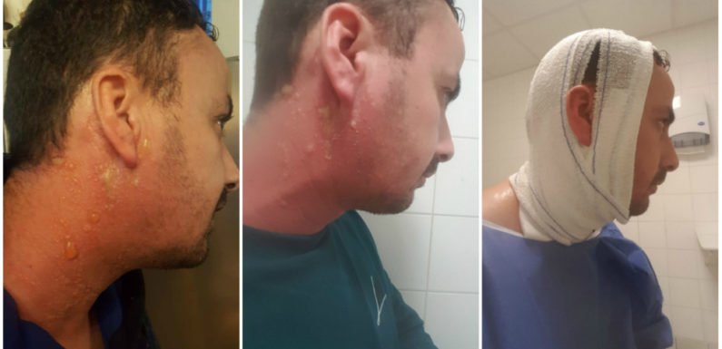 Un kabyle attaqué à l’acide par des algériens lors d’une manifestation à Paris